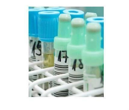 液体药剂 非即饮型茶的创新应用与市场前景